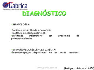 HISTOLOGIA:
•Presencia de infiltrado inflamatorio.
•Presencia de edema endotelial.
•Infiltrado inflamatorio con predominio de
polimorfonucleares.
INMUNOFLUORESCENCIA DIRECTA:
•Inmunocomplejos depositados en los vasos dérmicos.
(Rodríguez, Saiz et al, 2006)
 