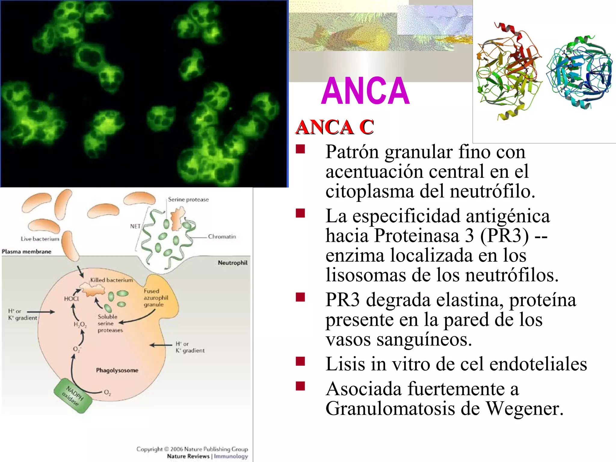 Vasculitis WegeneChurg S | PPT