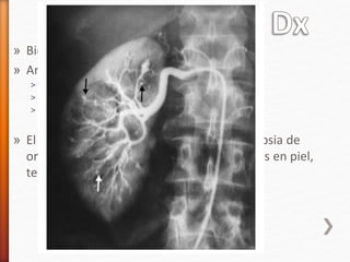 » Biopsia con datos de vasculitis
» Angiografía de vasos afectados
˃ Aneurismas (renal, hepática, visceral)
˃ Estenosis
˃ Obliteraciones vasculares
» El mayor rendimiento Dx se obtiene de biopsia de
organos afectados, como lesiones nodulares en piel,
testículos dolorosos, nervios/musculos
 