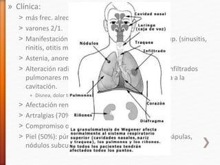 » Clínica:
˃ más frec. alrededor de los 40 años.
˃ varones 2/1.
˃ Manifestación inicial: afección de las vías resp. sup. (sinusitis,
rinitis, otitis media).
˃ Astenia, anorexia, pérdida de peso.
˃ Alteración radiológica pulmonar (más del 85%): infiltrados
pulmonares múltiples y/o nódulos, con tendencia a la
cavitación.
+ Disnea, dolor toráxico, hemoptisis.
˃ Afectación renal : 80% (primeros 2 años).
˃ Artralgias (70%), poliartritis.
˃ Compromiso ocular (60%): escleritis, uveítis.
˃ Piel (50%): púrpura en extremidades inferiores, pápulas,
nódulos subcutáneos.
 