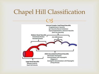 
Chapel Hill Classification
 