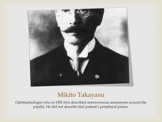 Mikito Takayasu
Ophthalmologist who in 1901 first described arteriovenous anatamosis around the
papilla. He did not describe that patient’s peripheral pulses.
 