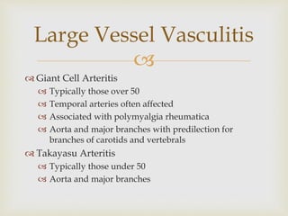 
 Giant Cell Arteritis
 Typically those over 50
 Temporal arteries often affected
 Associated with polymyalgia rheumatica
 Aorta and major branches with predilection for
branches of carotids and vertebrals
 Takayasu Arteritis
 Typically those under 50
 Aorta and major branches
Large Vessel Vasculitis
 