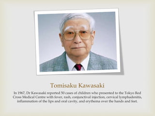 Tomisaku Kawasaki
In 1967, Dr Kawasaki reported 50 cases of children who presented to the Tokyo Red
Cross Medical Centre with fever, rash, conjunctival injection, cervical lymphadenitis,
inflammation of the lips and oral cavity, and erythema over the hands and feet.
 