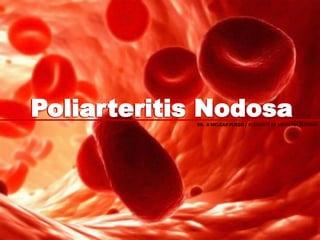 Poliarteritis NodosaPoliarteritis NodosaDR. A MELGAR PLIEGO / RESIDENTE DE MEDICINA INTERNA
 