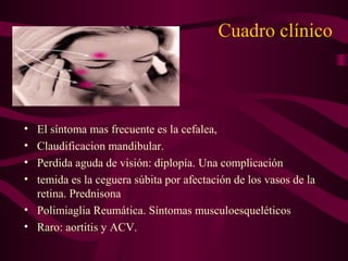 Cuadro clínico



• El síntoma mas frecuente es la cefalea,
• Claudificacion mandibular.
• Perdida aguda de visión: diplopía. Una complicación
• temida es la ceguera súbita por afectación de los vasos de la
  retina. Prednisona
• Polimiaglia Reumática. Síntomas musculoesqueléticos
• Raro: aortitis y ACV.
 