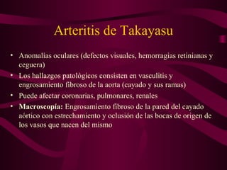Arteritis de Takayasu
• Anomalías oculares (defectos visuales, hemorragias retinianas y
  ceguera)
• Los hallazgos patológicos consisten en vasculitis y
  engrosamiento fibroso de la aorta (cayado y sus ramas)
• Puede afectar coronarias, pulmonares, renales
• Macroscopía: Engrosamiento fibroso de la pared del cayado
  aórtico con estrechamiento y oclusión de las bocas de origen de
  los vasos que nacen del mismo
 