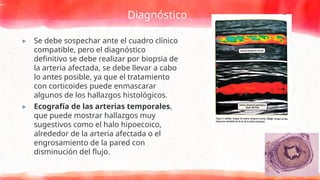 Diagnóstico
▸ Se debe sospechar ante el cuadro clínico
compatible, pero el diagnóstico
definitivo se debe realizar por biopsia de
la arteria afectada, se debe llevar a cabo
lo antes posible, ya que el tratamiento
con corticoides puede enmascarar
algunos de los hallazgos histológicos.
▸ Ecografía de las arterias temporales,
que puede mostrar hallazgos muy
sugestivos como el halo hipoecoico,
alrededor de la arteria afectada o el
engrosamiento de la pared con
disminución del flujo.
 