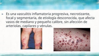 ▸ Es una vasculitis inflamatoria progresiva, necrotizante,
focal y segmentaria, de etiología desconocida, que afecta
vasos de mediano y pequeño calibre, sin afección de
arteriolas, capilares y vénulas.
29
 