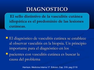 DIAGNOSTICODIAGNOSTICO
El sello distintivo de la vasculitis cutánea
idiopática es el predominio de las lesiones
cutáneas.
 El diagnóstico de vasculitis cutánea se estableceEl diagnóstico de vasculitis cutánea se establece
al observar vasculitis en la biopsia. Un principioal observar vasculitis en la biopsia. Un principio
importante para el diagnóstico en losimportante para el diagnóstico en los
 pacientes con vasculitis cutánea es buscar lapacientes con vasculitis cutánea es buscar la
causa del problemacausa del problema
Harrison. Medicina Interna 17 Edicion. Cap. 319. pag 2119
 