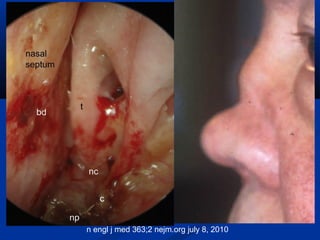 n engl j med 363;2 nejm.org july 8, 2010
 