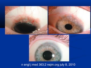 n engl j med 363;2 nejm.org july 8, 2010
 