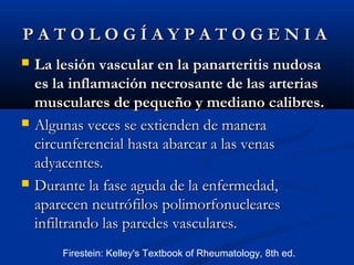 P A T O L O G Í A Y P A T O G E N I AP A T O L O G Í A Y P A T O G E N I A
 La lesión vascular en la panarteritis nudosaLa lesión vascular en la panarteritis nudosa
es la inflamación necrosante de las arteriases la inflamación necrosante de las arterias
musculares de pequeño y mediano calibres.musculares de pequeño y mediano calibres.
 Algunas veces se extienden de maneraAlgunas veces se extienden de manera
circunferencial hasta abarcar a las venascircunferencial hasta abarcar a las venas
adyacentes.adyacentes.
 Durante la fase aguda de la enfermedad,Durante la fase aguda de la enfermedad,
aparecen neutrófilos polimorfonuclearesaparecen neutrófilos polimorfonucleares
infiltrando las paredes vasculares.infiltrando las paredes vasculares.
Firestein: Kelley's Textbook of Rheumatology, 8th ed.
 