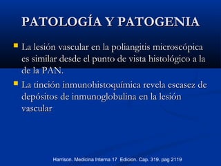 PATOLOGÍA Y PATOGENIAPATOLOGÍA Y PATOGENIA
 La lesión vascular en la poliangitis microscópicaLa lesión vascular en la poliangitis microscópica
es similar desde el punto de vista histológico a laes similar desde el punto de vista histológico a la
de la PAN.de la PAN.
 La tinción inmunohistoquímica revela escasez deLa tinción inmunohistoquímica revela escasez de
depósitos de inmunoglobulinadepósitos de inmunoglobulina en la lesiónen la lesión
vascularvascular
Harrison. Medicina Interna 17 Edicion. Cap. 319. pag 2119
 
