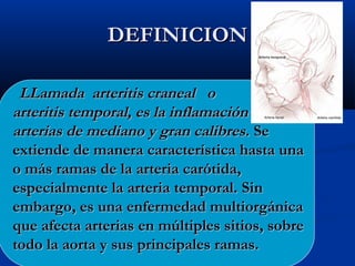 DEFINICIONDEFINICION
LLamada arteritis craneal oLLamada arteritis craneal o
arteritis temporal, es la inflamación de lasarteritis temporal, es la inflamación de las
arterias de mediano y gran calibres.arterias de mediano y gran calibres. SeSe
extiende de manera característica hasta unaextiende de manera característica hasta una
o más ramas de la arteria carótida,o más ramas de la arteria carótida,
especialmente la arteria temporal. Sinespecialmente la arteria temporal. Sin
embargo, es una enfermedad multiorgánicaembargo, es una enfermedad multiorgánica
que afecta arterias en múltiples sitios, sobreque afecta arterias en múltiples sitios, sobre
todo la aorta y sustodo la aorta y sus principales ramas.principales ramas.
 