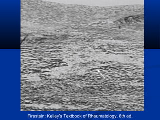 Firestein: Kelley's Textbook of Rheumatology, 8th ed.
 