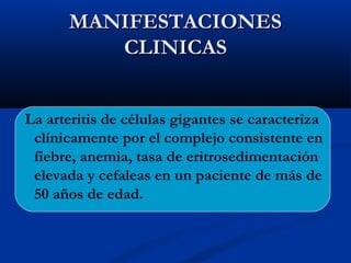 MANIFESTACIONESMANIFESTACIONES
CLINICASCLINICAS
La arteritis de células gigantes se caracteriza
clínicamente por el complejo consistente en
fiebre, anemia, tasa de eritrosedimentación
elevada y cefaleas en un paciente de más de
50 años de edad.
 