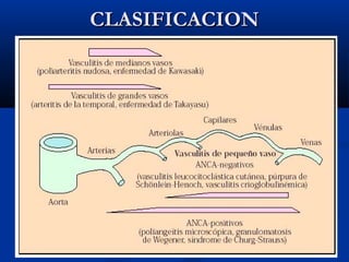 CLASIFICACIONCLASIFICACION
 