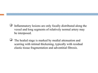 -
 Inflammatory lesions are only focally distributed along the
vessel and long segments of relatively normal artery may
be interposed.
 The healed stage is marked by medial attenuation and
scarring with intimal thickening, typically with residual
elastic tissue fragmentation and adventitial fibrosis.
 