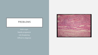 PROBLEMS
Multi-organ
Rapidly progressive
Life-threatening
Difficult to diagnose
 