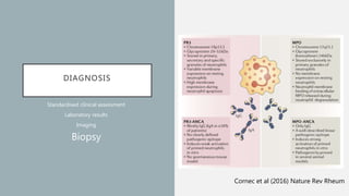 DIAGNOSIS
Standardised clinical assessment
Laboratory results
Imaging
Biopsy
Cornec et al (2016) Nature Rev Rheum
 
