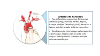 Arteritis de Takayasu
• Fase inflamatoria: predominio de sintomas
sistemicos (fatiga, malestar, perdida de peso,
artralgia, mialgias, fiebre bajo grado), evolucion a
fase de oclusion vascular sintomas isquemicos
• Claudicacion de extremidades, pulsos ausentes
o disminuidos. Hipertension presente en la
mayoria de los pacientes. Subclavia: sincope,
sintomas neurologicos.
 
