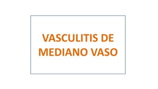 VASCULITIS DE
MEDIANO VASO
 