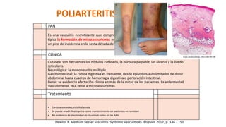 POLIARTERITIS NODOSA
- PAN
Es una vasculitis necrotizante que compromete arterias de mediano y pequeño calibre, siendo
típica la formación de microaneurismas en los vasos afectados. Es más frecuente en varones con
un pico de incidencia en la sexta década de la vida
CLINICA
_-
Cutánea: son frecuentes los nódulos cutáneos, la púrpura palpable, las úlceras y la livedo
reticularis.
Neurológica: la mononeuritis múltiple
Gastrointestinal: la clínica digestiva es frecuente, desde episodios autolimitados de dolor
abdominal hasta cuadros de hemorragia digestiva o perforación intestinal.
Renal: se evidencia afectación clínica en más de la mitad de los pacientes. La enfermedad
Vasculorrenal, HTA renal a microaneurismas.
Tratamiento
4
• Corticoesteroides, ciclofosfamida
• Se puede anadir Azatioprina como mantenimiento en pacientes en remision
• No evidencia de efectividad de rituximab como en las AAV.
Hewins P. Medium vessel vasculitis. Systemic vasculitides. Elsevier 2017, p. 146 - 150.
 