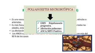 Poliangeítis microscópica (PAM)
• Es una vasculitis necrotizante que afecta primariamente a capilares, vénulas o
arteriolas.
• Es más frecuentes en personas ancianas, aunque se han descrito en todas las
edades, estando igualmente afectados ambos sexos.
• La afectación renal es muy frecuente (80 - 90 %).
• Los ANCA suelen ser p-ANCA (anti-MPO), encontrándose presentes en más del
90 % de los casos
 