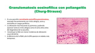 Granulomatosis eosinofílica con poliangeítis
(Churg-Strauss)
• Es una vasculitis necrotizante eosinofílica granulomatosa,
asociada frecuentemente con rinitis alérgica, asma y
eosinofilia en sangre periférica.
• La afectación más frecuente es pulmonar, pudiendo
aparecer tanto la rinitis alérgica como el asma años antes
del diagnóstico de la vasculitis.
• Constituye la VAA con menor incidencia de afectación
renal (20-40 %).
• A diferencia de la PAM y de la GPA aparece en edades más
tempranas.
 