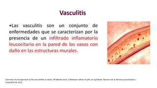 Vasculitis
•Las vasculitis son un conjunto de
enfermedades que se caracterizan por la
presencia de un infiltrado inflamatorio
leucocitario en la pared de los vasos con
daño en las estructuras murales.
Overview of and approach to the vasculitides in adults. PA Merkel autor, E Matteson editor en jefe, en UpToDate. Revision de la literatura actualizada a
noviembre de 2015.
 