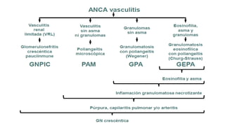 Vasculititis pulmon -riñon