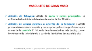  Arteritis de Takayasu: Afecta la aorta y ramas principales. La
enfermedad se inicia habitualmente antes de los 30 años.
 Arteritis de células gigantes o arteritis de la temporal : Afecta
predominantemente la aorta y ramas principales, con preferencia por
ramas de la carótida. El inicio de la enfermedad es más tardío, con un
incremento de la incidencia a partir de la séptima década de la vida.
Hashmi TM, Cardy CM, Carruthers D. Large vessel vasculitides. Systemic Vasculitides. Elsevier 2013, 151 - 155.
VASCULITIS DE GRAN VASO
 