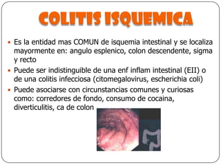 Colitis isquemicaEs la entidad mas COMUN de isquemia intestinal y se localiza mayormente en: angulo esplenico, colon descendente, sigma y rectoPuede ser indistinguible de una enf inflam intestinal (EII) o de una colitis infecciosa (citomegalovirus, escherichia coli)Puede asociarse con circunstancias comunes y curiosas como: corredores de fondo, consumo de cocaina, diverticulitis, ca de colon
