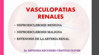 VASCULOPATIAS
RENALES
• NEFROESCLEROSIS BENIGNA
• NEFROESCLEROSIS MALIGNA
• ESTENOSIS DE LA ARTERIA RENAL
Dr. ESPINOZA ESCUDERO CRISTIAN OLIVER
 