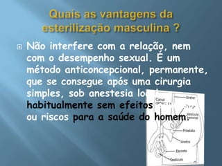 Quais as vantagens da esterilização masculina ?Não interfere com a relação, nem com o desempenho sexual. É um método anticoncepcional, permanente, que se consegue após uma cirurgia simples, sob anestesia local, e habitualmente sem efeitos adversos ou riscos para a saúde do homem.