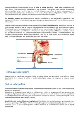 Vasectomie | PDF