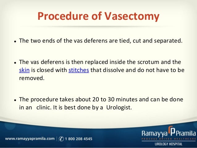 Saving male sperm before visectamy Were Saving male sperm before visectamy safe answer