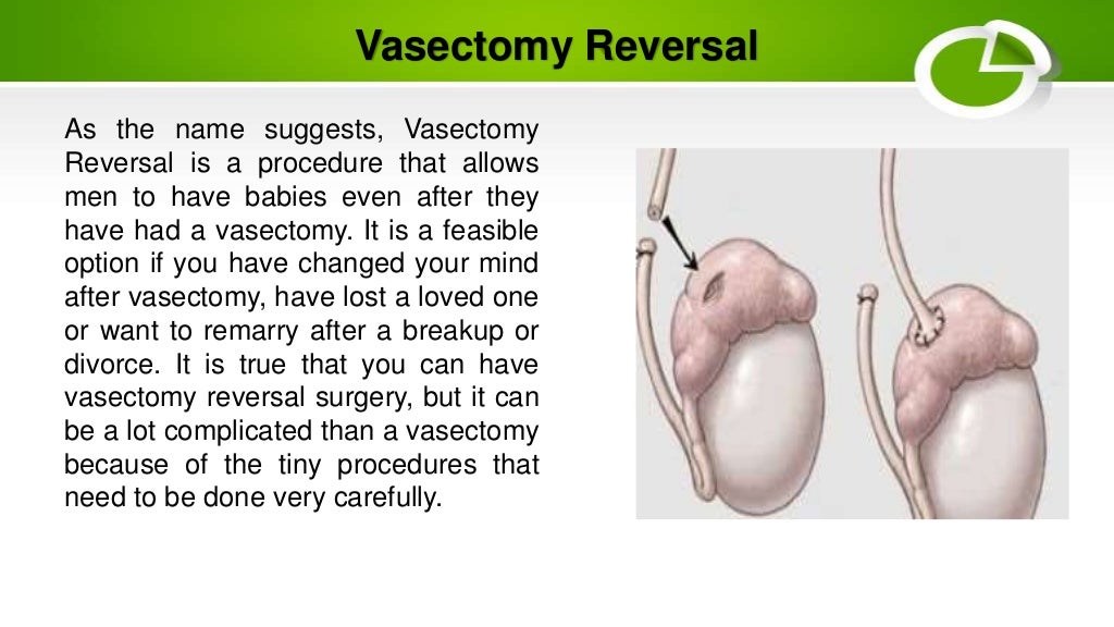 Vasectomy Reversal Vasectomy Reversal