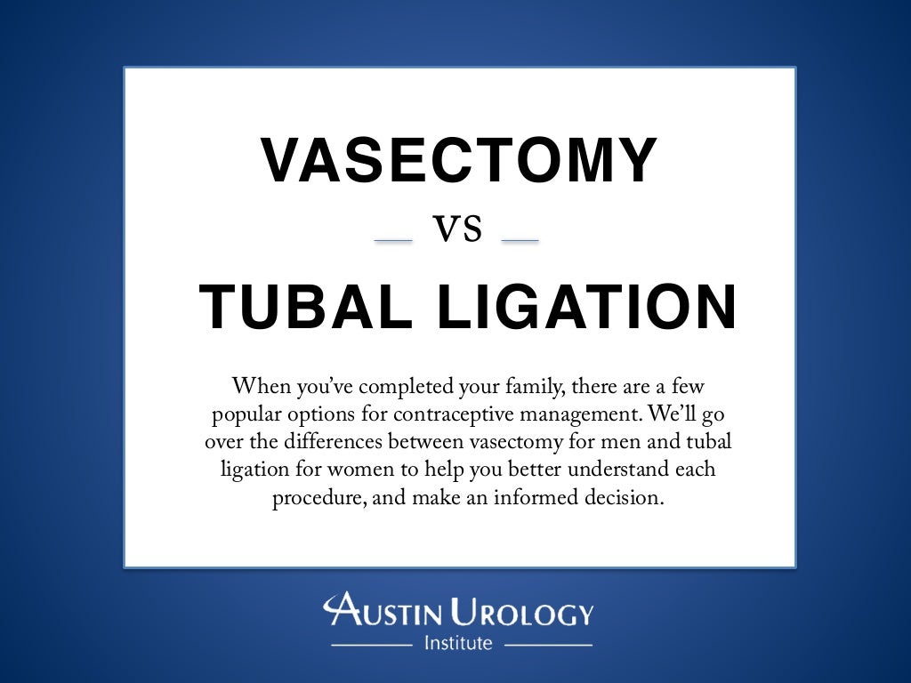 Vasectomy vs. Tubal Ligation