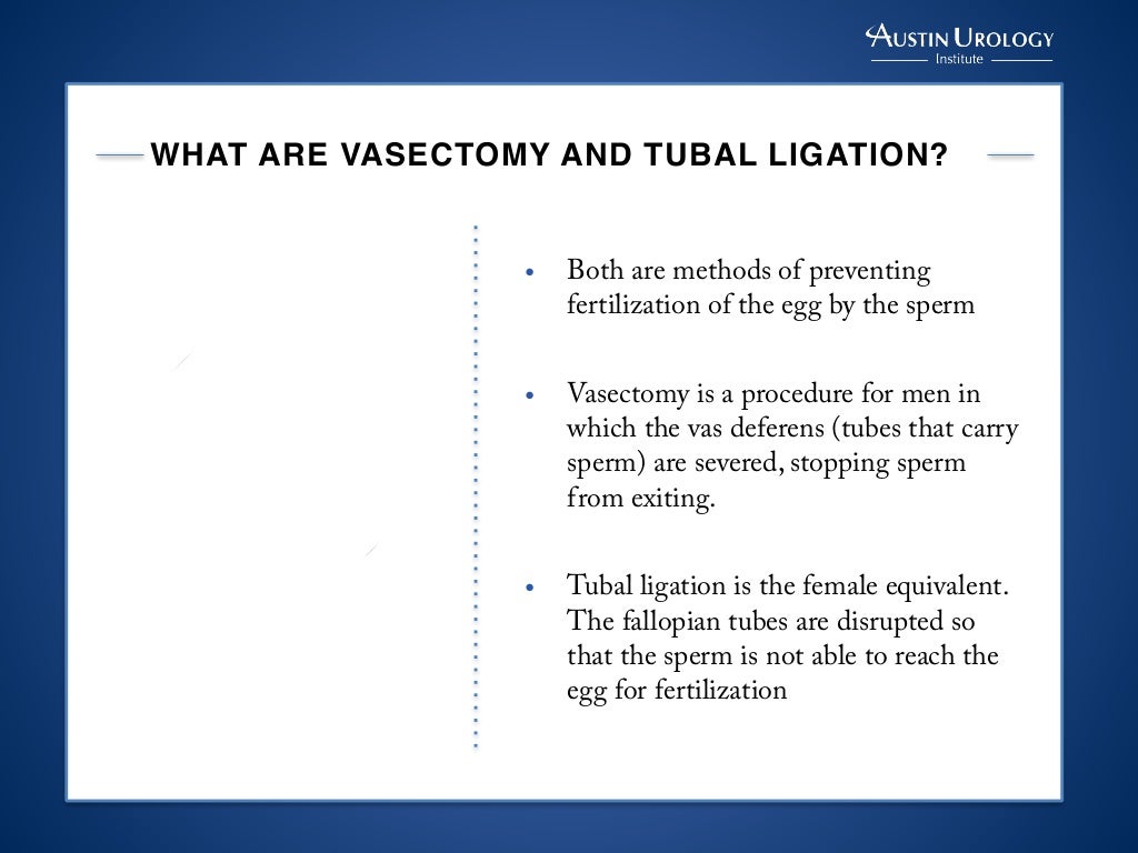 Vasectomy vs. Tubal Ligation