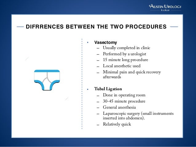 Vasectomy vs. Tubal Ligation