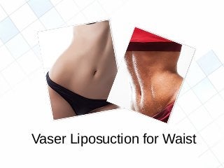 Vaser Liposuction for Waist
 