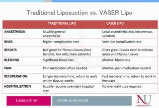 Traditional Liposuction vs. VASER Lipo
REFINE YOUR FIGURE
TRADITIONAL LIPO VASER LIPO
ANAESTHESIA Usually general
anaesthesia
Local anaesthetic plus intravenous
sedation
RISKS Higher complication rate Very low complication rate
RESULTS Not good for fibrous tissues (love
handles, bra rolls, male patients)
Gives great results even in delicate
areas and fibrous tissues
BLEEDING Significant blood loss Minimal blood loss
PAIN Pain medication often needed Minimal pain medication needed
RECUPERATION Longer recovery time, return to work
within days or weeks
Fast recovery time, return to work in
few days
HOSPITALIZATION Usually requires overnight hospital
stay
No overnight stay required
ELIMINATE FAT
 