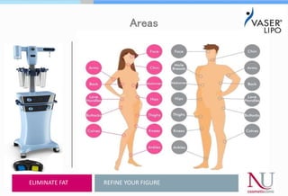 Areas
REFINE YOUR FIGUREELIMINATE FAT
 