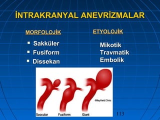 113
İNTRAKRANYAL ANEVRİZMALARİNTRAKRANYAL ANEVRİZMALAR
MORFOLOJİKMORFOLOJİK
 SakkülerSakküler
 FusiformFusiform
 DissekanDissekan
ETYOLOJİKETYOLOJİK
MikotikMikotik
TravmatikTravmatik
EmbolikEmbolik
 