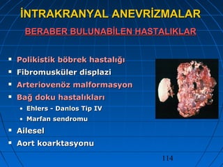 114
İNTRAKRANYAL ANEVRİZMALARİNTRAKRANYAL ANEVRİZMALAR
BERABER BULUNABİLEN HASTALIKLARBERABER BULUNABİLEN HASTALIKLAR
 Polikistik böbrek hastalığıPolikistik böbrek hastalığı
 Fibromusküler displaziFibromusküler displazi
 Arteriovenöz malformasyonArteriovenöz malformasyon
 Bağ doku hastalıklarıBağ doku hastalıkları
• Ehlers - Danlos Tip IVEhlers - Danlos Tip IV
• Marfan sendromuMarfan sendromu
 AileselAilesel
 Aort koarktasyonuAort koarktasyonu
 
