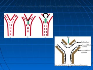 117
İİNTRAKRANYALNTRAKRANYAL AANEVRİZMALARINNEVRİZMALARIN PPATOGENEZİATOGENEZİ
 