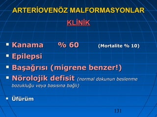 131
ARTERİOVENÖZ MALFORMASYONLARARTERİOVENÖZ MALFORMASYONLAR
KLİNİKKLİNİK
 KanamaKanama % 60% 60 (Mortalite % 10)(Mortalite % 10)
 EpilepsiEpilepsi
 Başağrısı (migrene benzer!)Başağrısı (migrene benzer!)
 Nörolojik defisitNörolojik defisit (normal dokunun beslenme(normal dokunun beslenme
bozukluğu veya basısına bağlı)bozukluğu veya basısına bağlı)
 ÜfürümÜfürüm
 