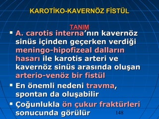 148
KAROTİKO-KAVERNÖZ FİSTÜLKAROTİKO-KAVERNÖZ FİSTÜL
TANIMTANIM
 A. carotis internaA. carotis interna’nın kavernöz’nın kavernöz
sinüs içinden geçerken verdiğisinüs içinden geçerken verdiği
meningo-hipofizeal dallarınmeningo-hipofizeal dalların
hasarıhasarı ile karotis arteri veile karotis arteri ve
kavernöz sinüs arasında oluşankavernöz sinüs arasında oluşan
arterio-venöz bir fistülarterio-venöz bir fistül
 En önemli nedeniEn önemli nedeni travmatravma,,
spontan da oluşabilirspontan da oluşabilir
 ÇoğunluklaÇoğunlukla ön çukur fraktürleriön çukur fraktürleri
sonucunda görülürsonucunda görülür
 